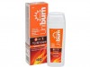uniburn_after_sun